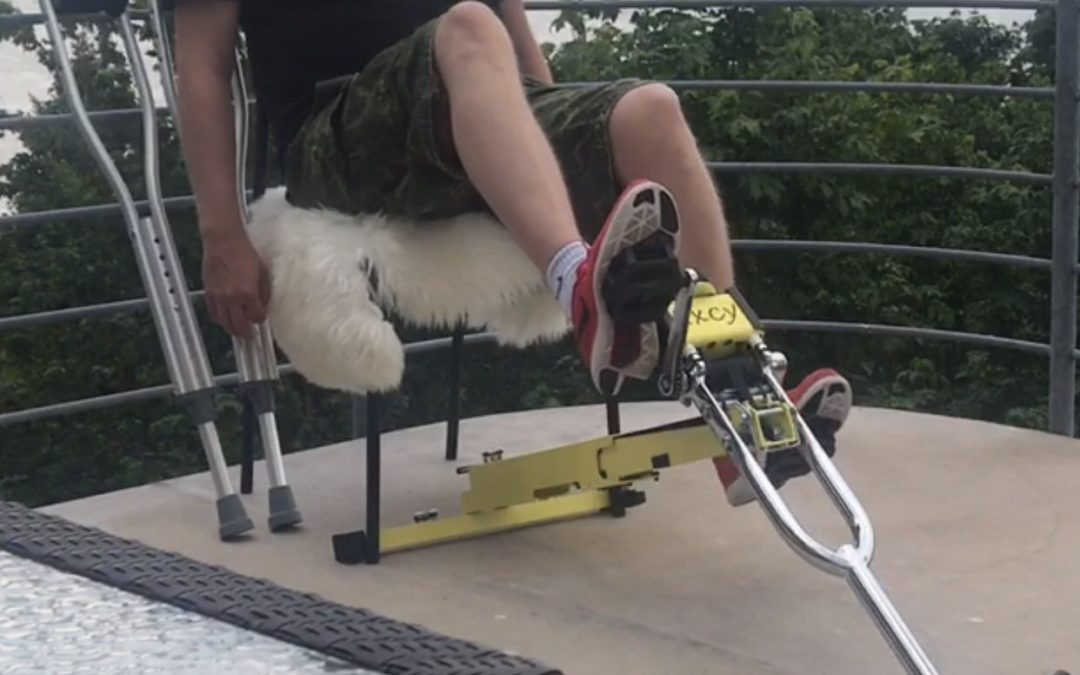 Excy Embraced as Portable Stationary Exercise Bike After Hip Surgery and for Life
